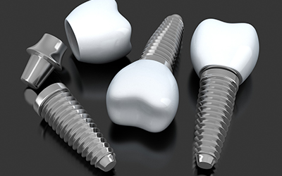 Animation of implant supported replacement teeth