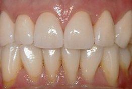 White healthy smile