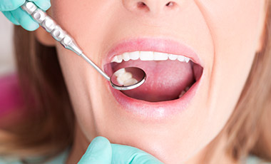 Closeup of smile during dental exam