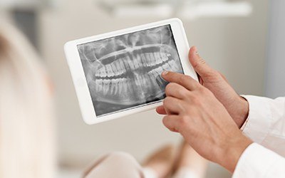 Hand holding tablet computer with dental x-rays